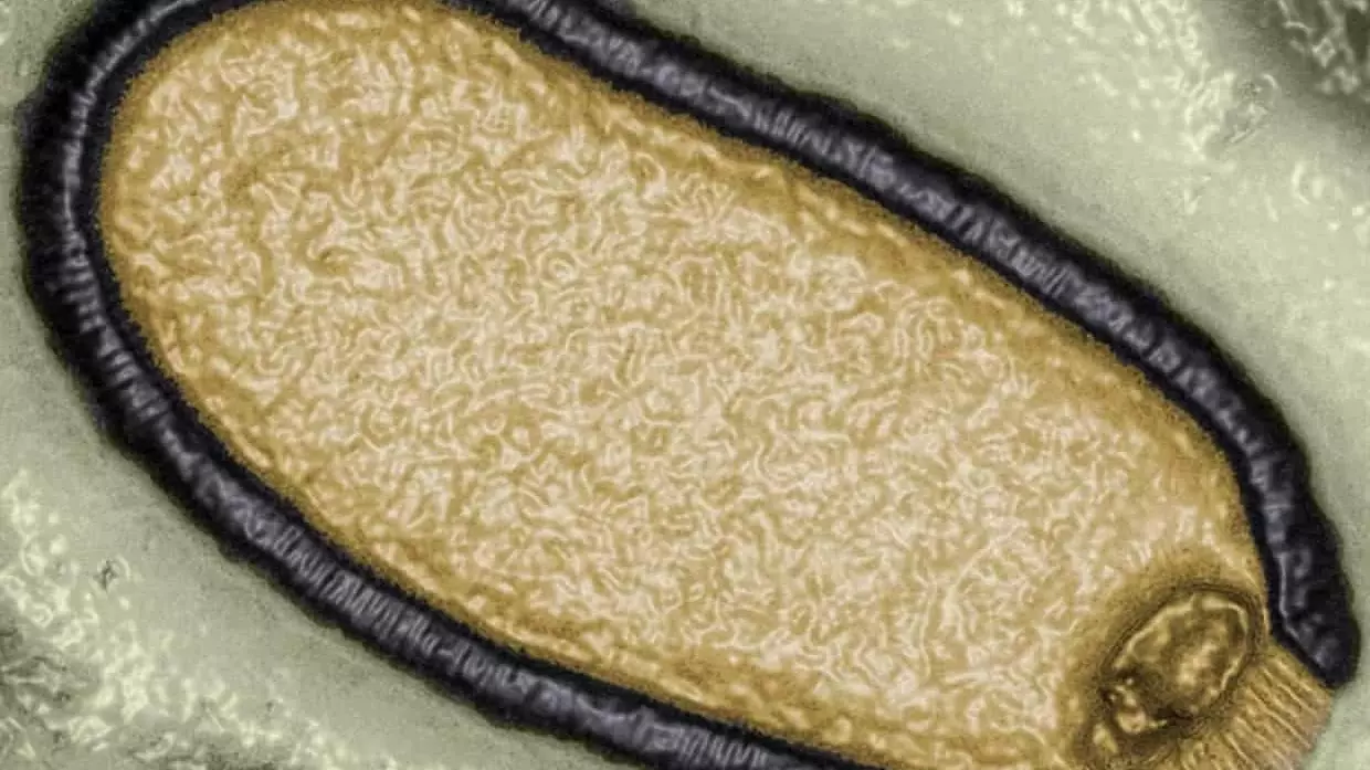 Компьютерное изображение Pithovirus sibericum, выделенного из образца вечной мерзлоты возрастом 30 000 лет в 2014 году.