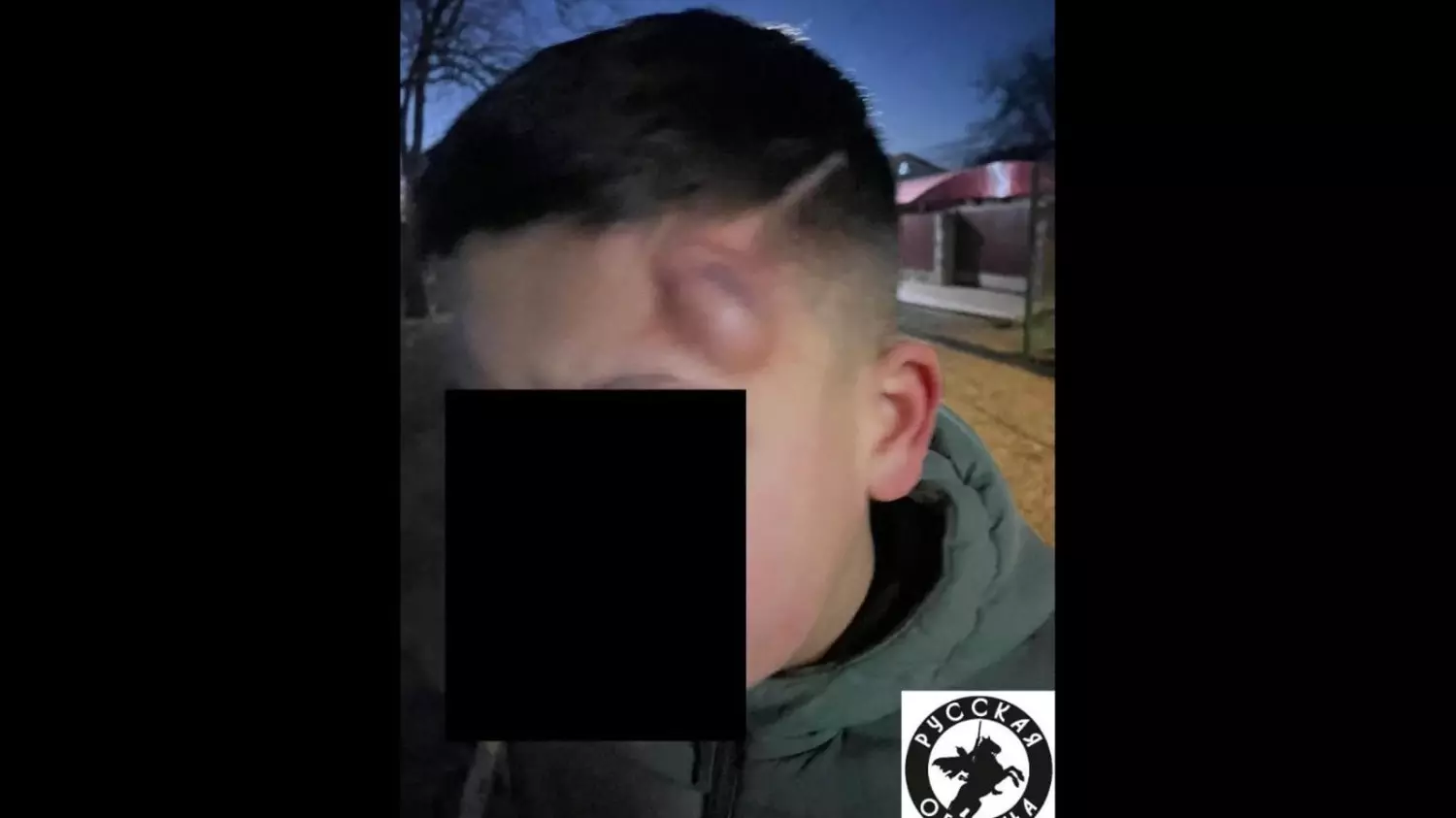 В результате стычки с мигрантом восьмиклассник из Ростовской области получил травму головы