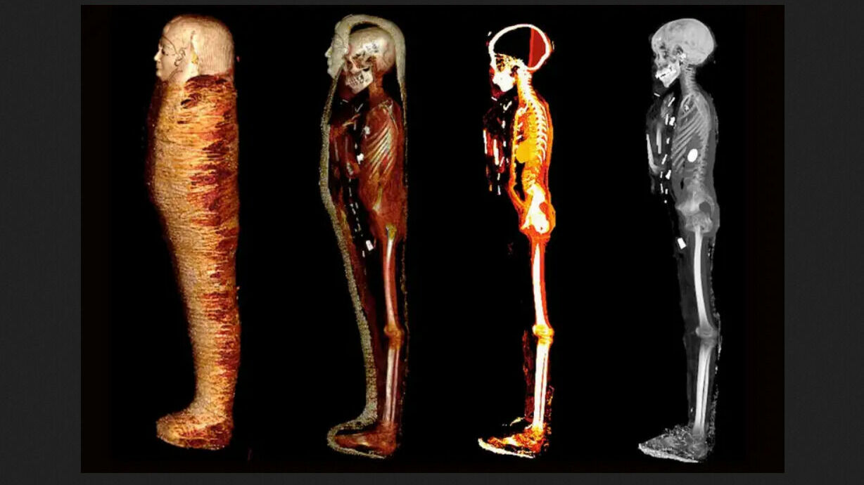 Египтологи просканировали мумию «золотого мальчика» и нашли второе сердце - скарабея