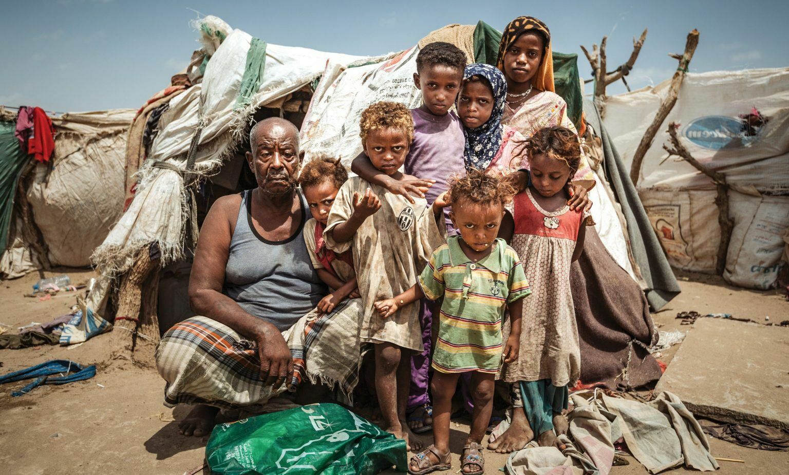 ООН не может накормить всех: в Йемене голодают миллионы взрослых и детей